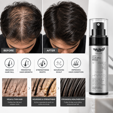 MAD Anti Hair Fall Serum - 50m